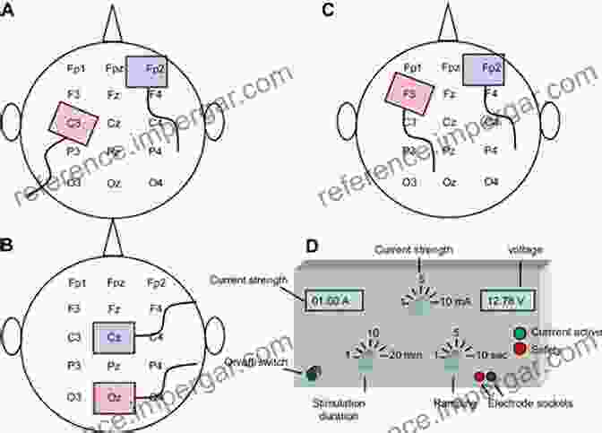 Diagram Of TDCS Electrodes Stimulating Different Brain Regions Practical Guide To Transcranial Direct Current Stimulation: Principles Procedures And Applications