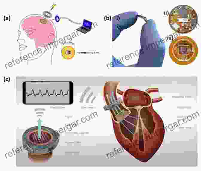 Implantable Sensor For Drug Delivery Monitoring Advanced Sensors For Biomedical Applications (Smart Sensors Measurement And Instrumentation 38)