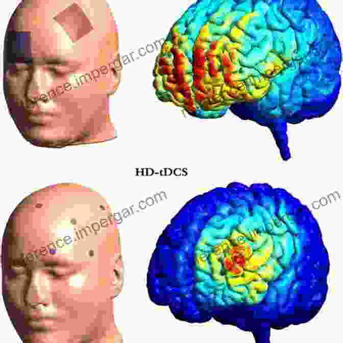 Visionary Depiction Of Future TDCS Applications Practical Guide To Transcranial Direct Current Stimulation: Principles Procedures And Applications