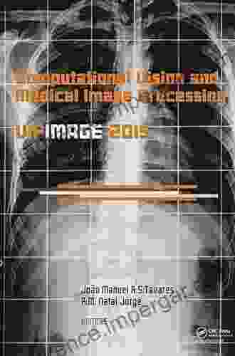 Computational Vision And Medical Image Processing V: Proceedings Of The 5th Eccomas Thematic Conference On Computational Vision And Medical Image 2024 Tenerife Spain October 19 21 2024)