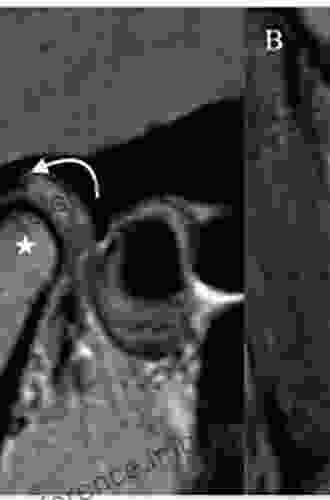 Imaging Of The Temporomandibular Joint