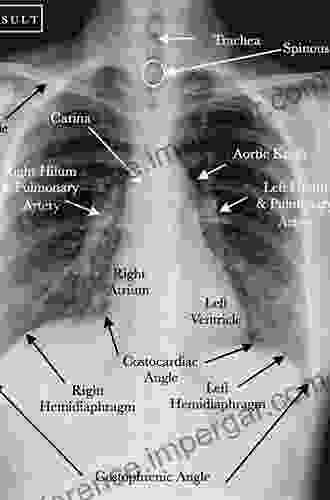 Thoracic Imaging: Basic To Advanced